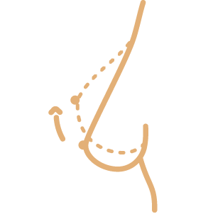 Cirugía corporal :